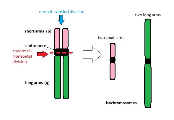 Isochromosome 17q