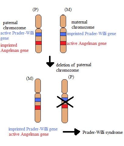 Prader Willi Syndrome Genetics