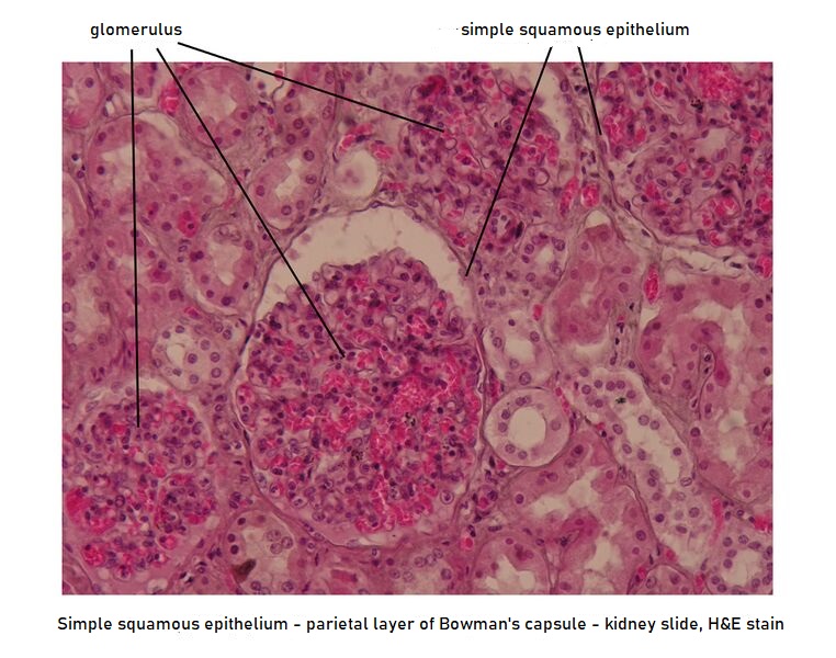 Simple Squamous Epithelium (image) - Wikilectures