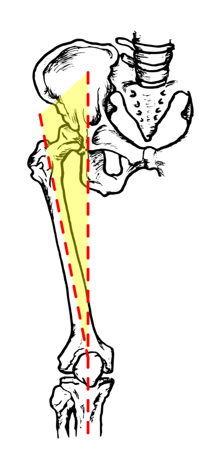 Patellofemoral syndrome - WikiLectures