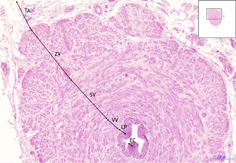 file-ductus-deferens-he-5x-jpeg-wikilectures