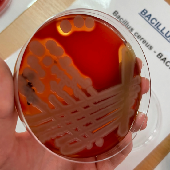 File:Bacillus cereus, KA.png - WikiLectures