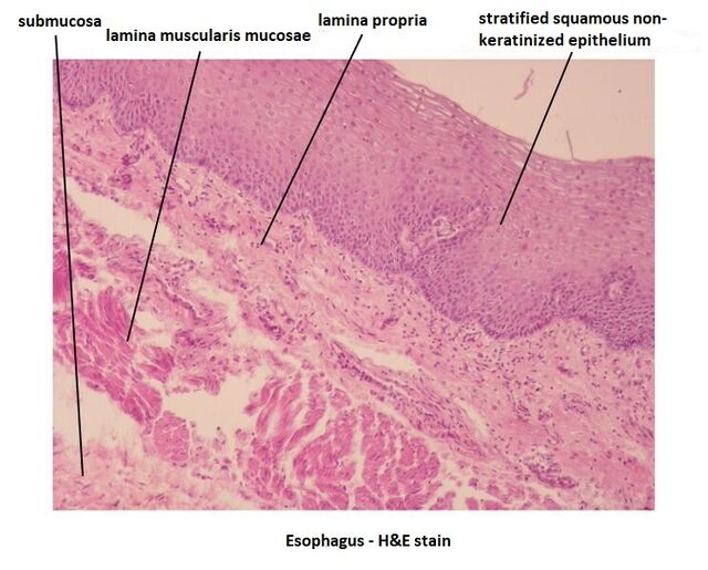 Esophagus (image) - WikiLectures