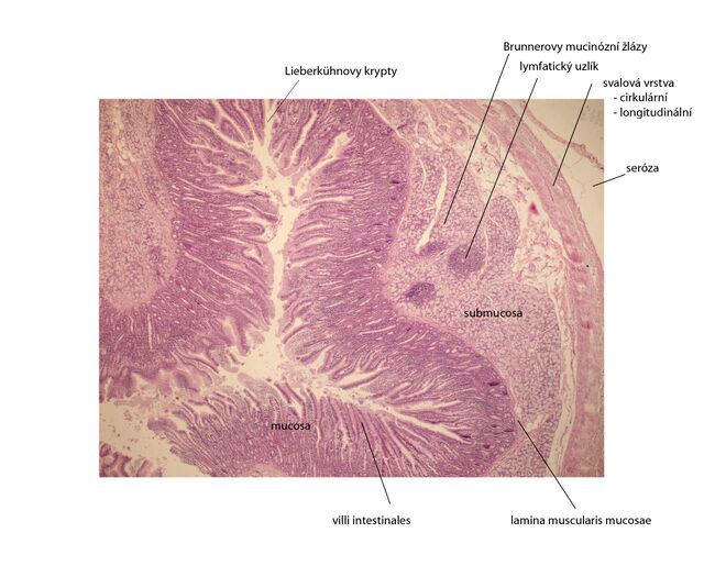 Duodenum (image) - WikiLectures