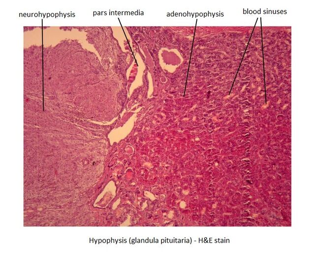 Hypophysis (image) - WikiLectures