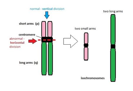 Isochromosomes - WikiLectures