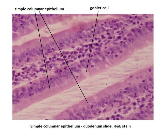 Simple columnar epithelium (image) - WikiLectures