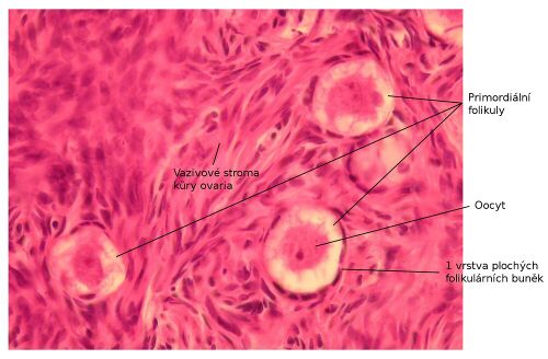 Ovarium3lf.jpg