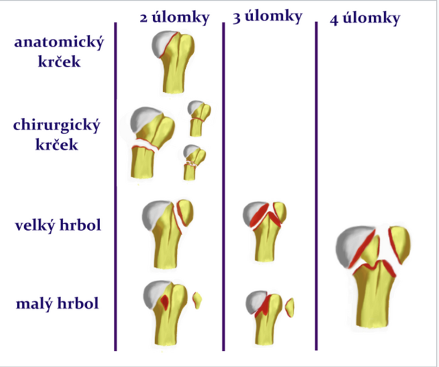 Neers Classification Wikilectures