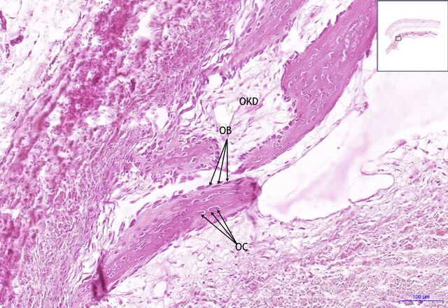 File:Skalp-Scalp (desmogenní osifikace- desmogenic osification), HE 10x ...