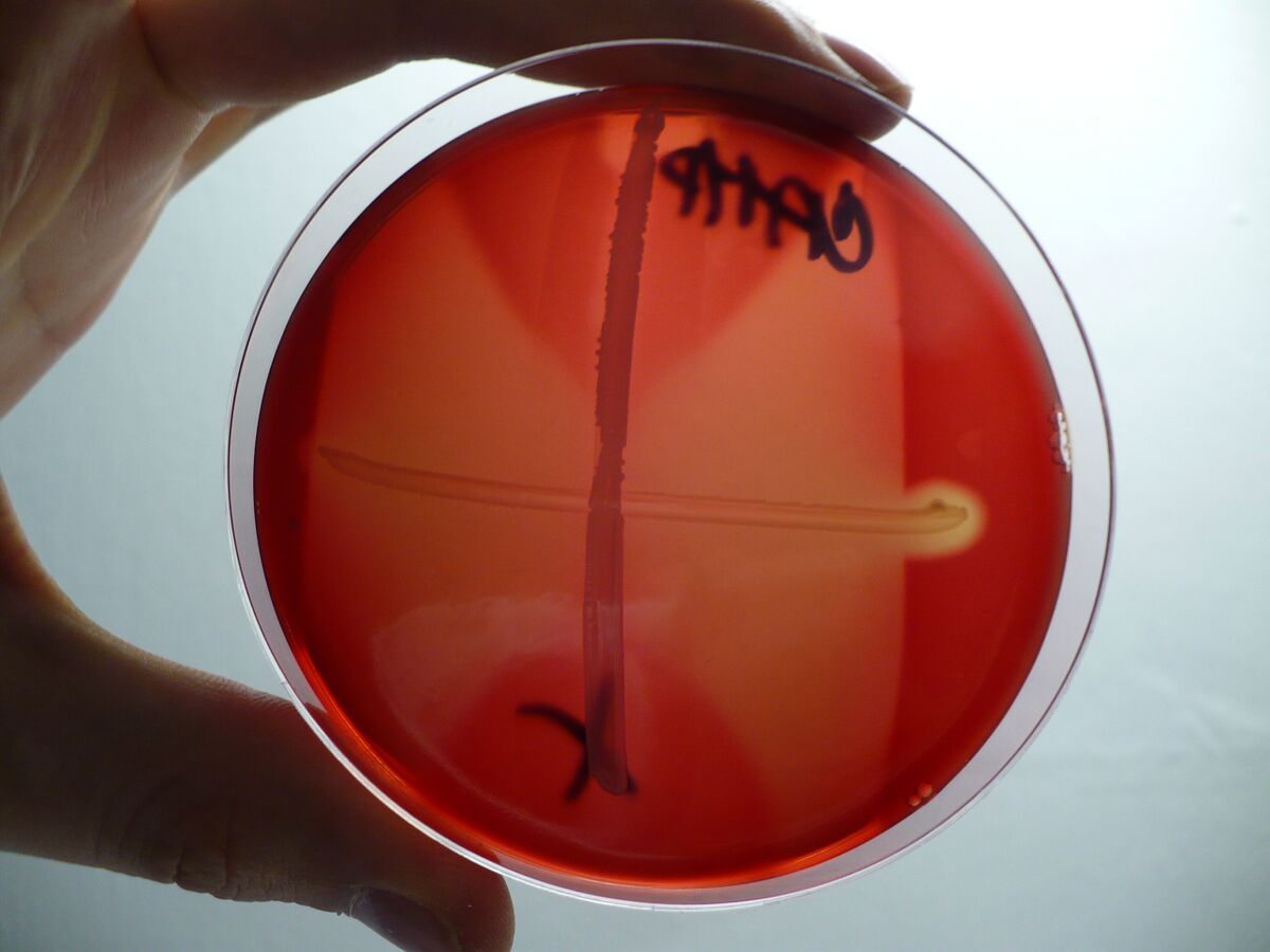 CAMP test showing half-moon shaped zone of complete hemolysis on a