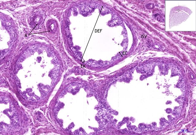 File:Testis-Epididymis, HE 10x.jpeg - WikiLectures