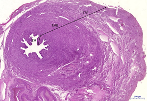 Uterine tube x2.png