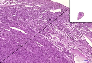 Uterine tube x5 .png